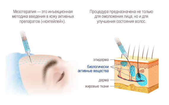 Методика мезотерапии для кожи на лице