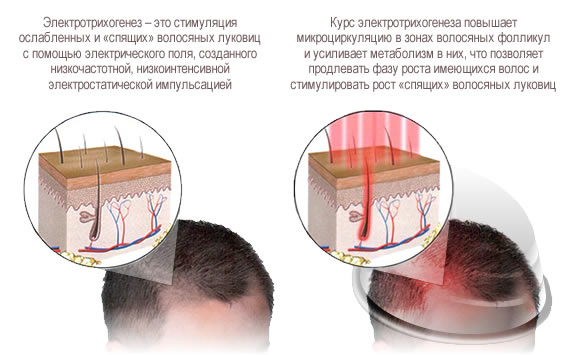 Электротрихогенез