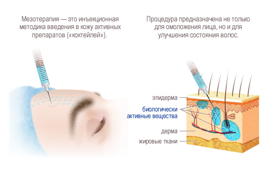 Мезотерапия Лица в Москве (Цена 3900р) Клиника Лантан