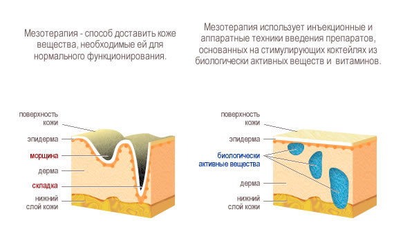 Сделать мезотерапию для тела