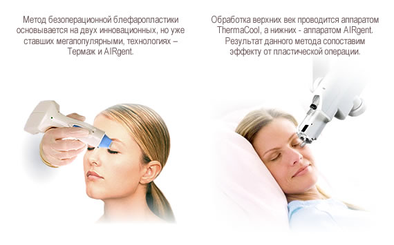 Безоперационная блефаропластика