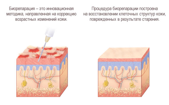 Биорепарация