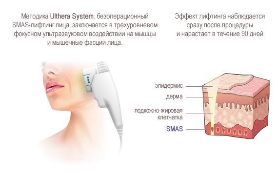 Подтяжка лица на аппарате альтера систем